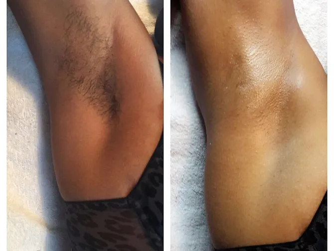 UNDERARM